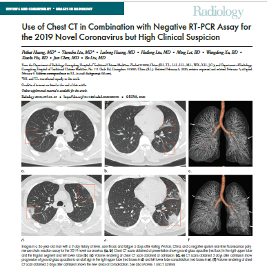 Use of Chest CT in Combination with Negative RT-PCR Assay for the 2019 Novel Coronavirus but High Clinical Suspicion